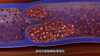 春运期间高发！经济舱坐久了，可能会猝死？图源：深圳卫健委